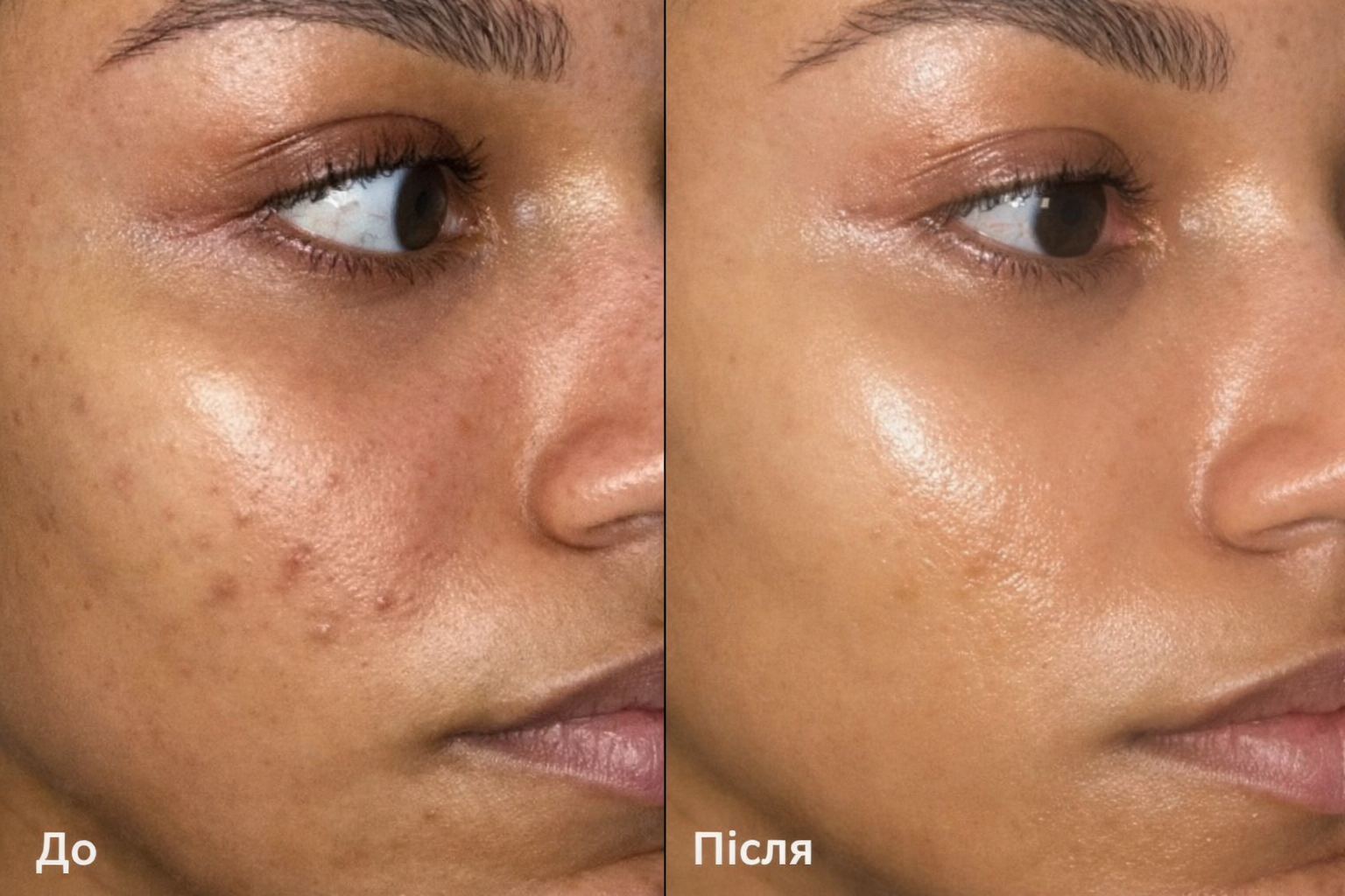 Arbutin 7% + Tranexamic Acid 4% Cream — Освітлюючий крем для шкіри обличчя