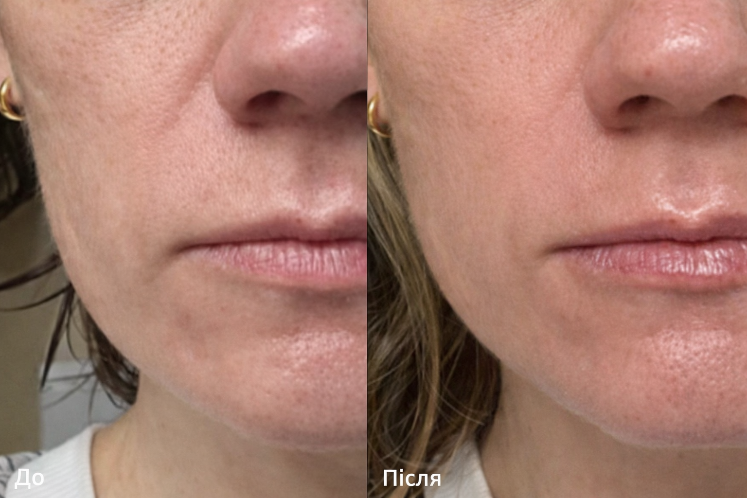 Arbutin 7% + Tranexamic Acid 4% Cream — Освітлюючий крем для шкіри обличчя